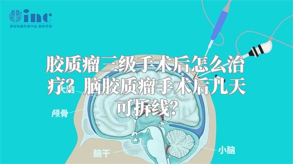 胶质瘤三级手术后怎么治疗？脑胶质瘤手术后几天可拆线？