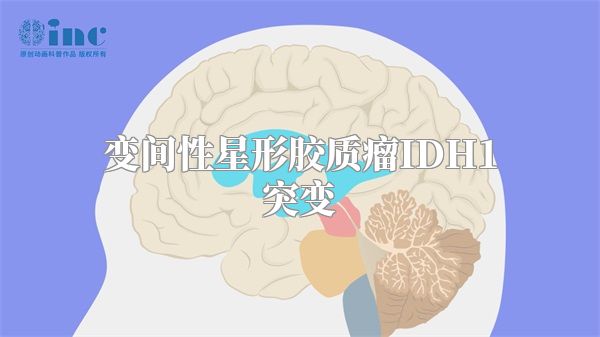 变间性星形胶质瘤IDH1突变