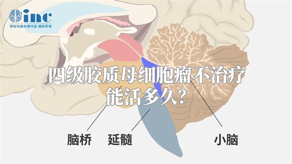 四级胶质母细胞瘤不治疗能活多久？