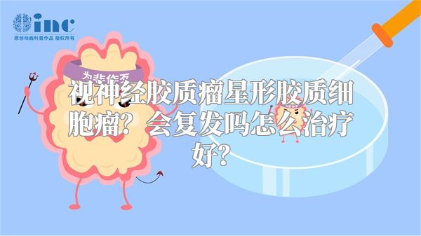 视神经胶质瘤星形胶质细胞瘤？会复发吗怎么治疗好？