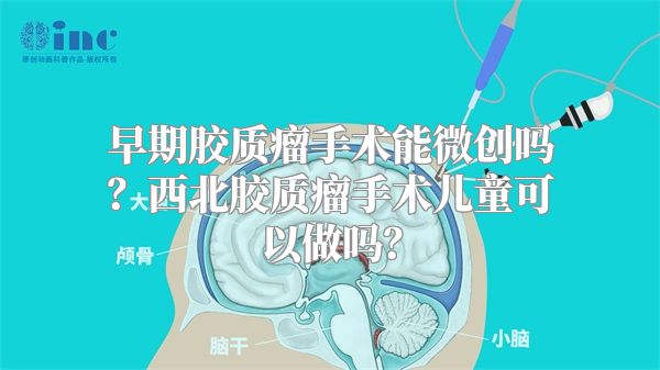 早期胶质瘤手术能微创吗？西北胶质瘤手术儿童可以做吗？