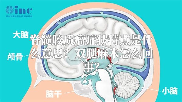 脊髓胶质瘤症状特点是什么意思？双腿麻木怎么回事？