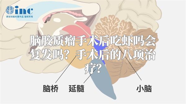 脑胶质瘤手术后吃虾吗会复发吗？手术后的八项治疗？