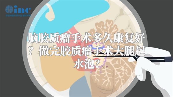 脑胶质瘤手术多久康复好？做完胶质瘤手术大腿起水泡？