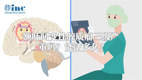 额叶间变性胶质瘤三级严重吗？能活多久？