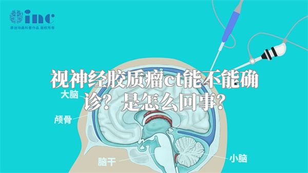 视神经胶质瘤ct能不能确诊？是怎么回事？