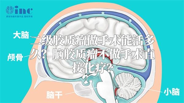 二级胶质瘤做手术能活多久？脑胶质瘤不做手术直接化疗？