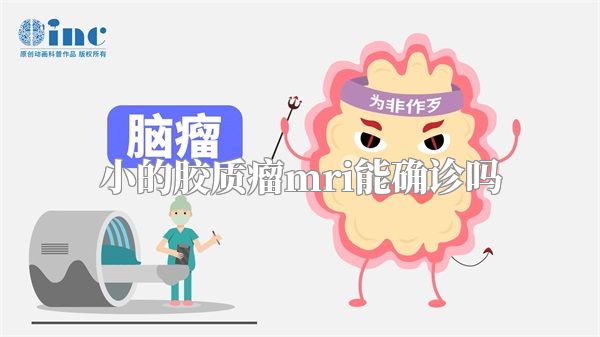 小的胶质瘤mri能确诊吗