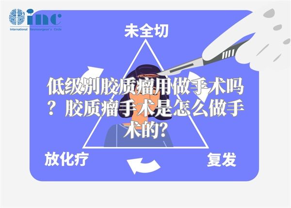 低级别胶质瘤用做手术吗？胶质瘤手术是怎么做手术的？