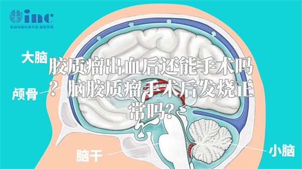 胶质瘤出血后还能手术吗？脑胶质瘤手术后发烧正常吗？