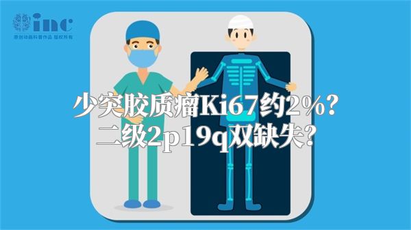 少突胶质瘤Ki67约2%？二级2p19q双缺失？