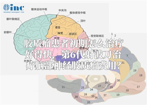 胶质瘤患者初期怎么治疗好得快，第6代射波刀治疗脑部神经胶质瘤费用？