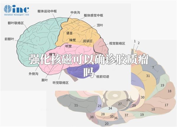 强化核磁可以确诊胶质瘤吗