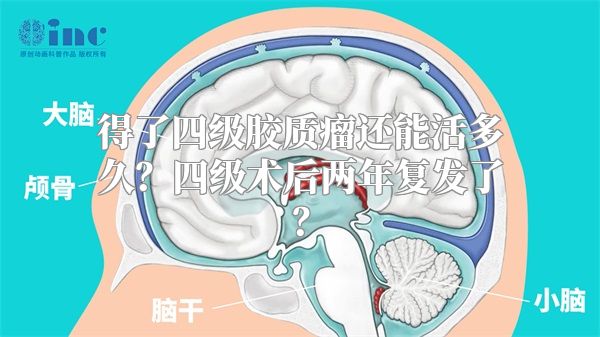 得了四级胶质瘤还能活多久？四级术后两年复发了？