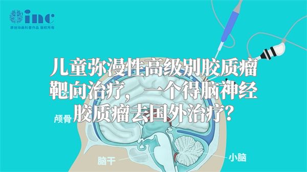 儿童弥漫性高级别胶质瘤靶向治疗，一个得脑神经胶质瘤去国外治疗？