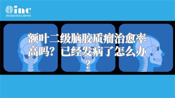 额叶二级脑胶质瘤治愈率高吗？已经发病了怎么办？