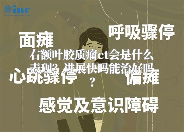 右额叶胶质瘤ct会是什么表现？进展快吗能治好吗？