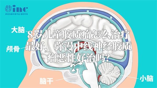 8岁儿童胶质瘤怎么治疗最好，弥漫中线神经胶质瘤恶性好治吗？