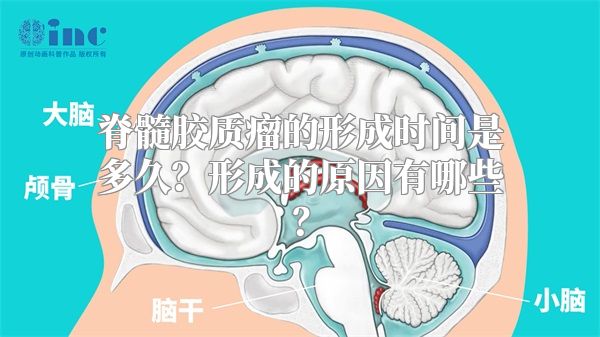 脊髓胶质瘤的形成时间是多久？形成的原因有哪些？