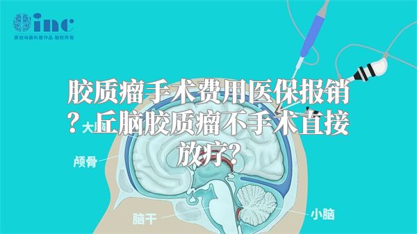 胶质瘤手术费用医保报销？丘脑胶质瘤不手术直接放疗？