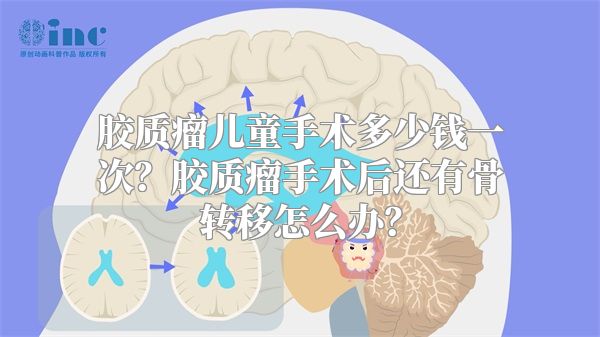 胶质瘤儿童手术多少钱一次？胶质瘤手术后还有骨转移怎么办？