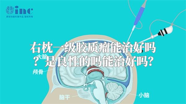 右枕一级胶质瘤能治好吗？是良性的吗能治好吗？