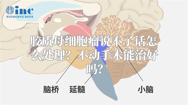 胶质母细胞瘤说不了话怎么处理？不动手术能治好吗？