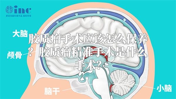 胶质瘤手术应该怎么保养？胶质瘤精准手术是什么手术？