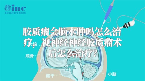 胶质瘤会脑水肿吗怎么治疗，视神经神经胶质瘤术后怎么治疗？