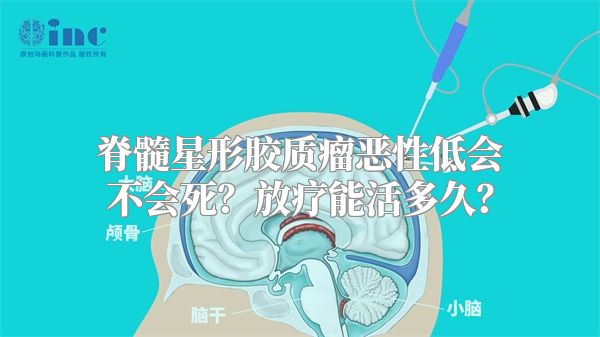 脊髓星形胶质瘤恶性低会不会死？放疗能活多久？