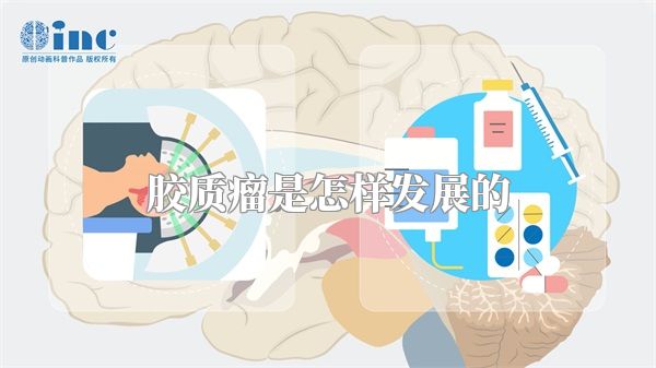 胶质瘤是怎样发展的