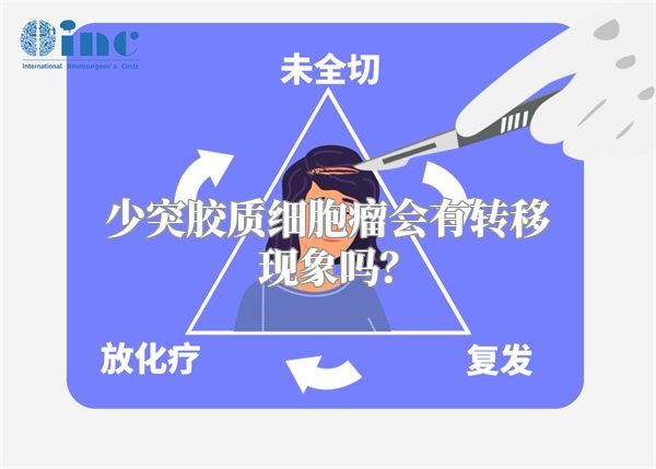 少突胶质细胞瘤会有转移现象吗？