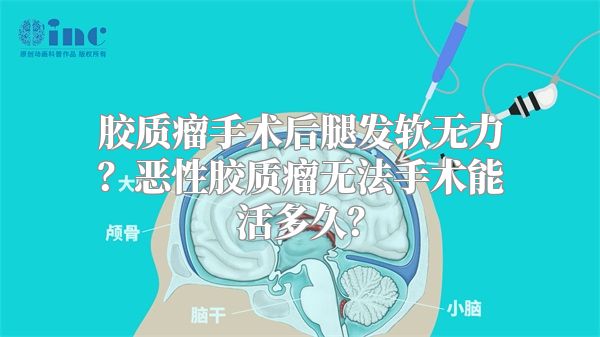 胶质瘤手术后腿发软无力？恶性胶质瘤无法手术能活多久？