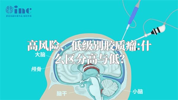 高风险、低级别胶质瘤:什么区分高与低？