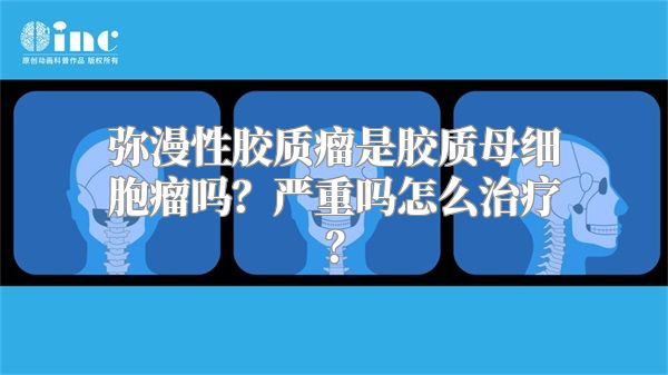 弥漫性胶质瘤是胶质母细胞瘤吗？严重吗怎么治疗？