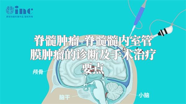 脊髓肿瘤-脊髓髓内室管膜肿瘤的诊断及手术治疗要点