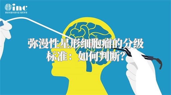 弥漫性星形细胞瘤的分级标准：如何判断？