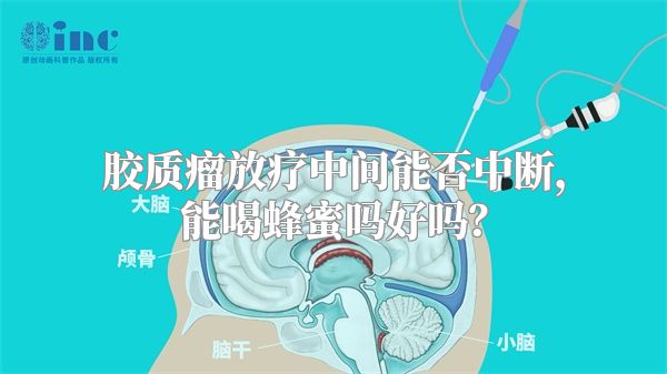 胶质瘤放疗中间能否中断，能喝蜂蜜吗好吗？