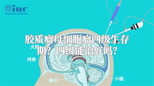 胶质瘤母细胞瘤四级生存期？四级能治好吗？