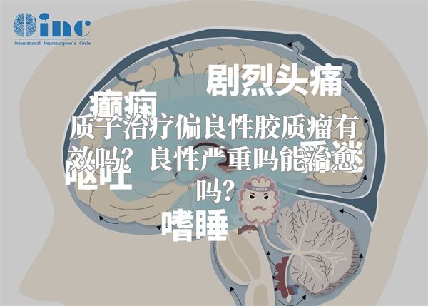 质子治疗偏良性胶质瘤有效吗？良性严重吗能治愈吗？