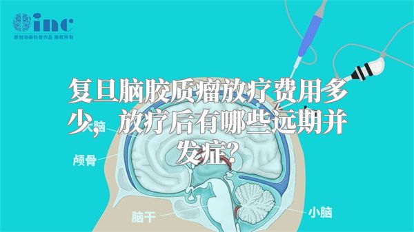 复旦脑胶质瘤放疗费用多少，放疗后有哪些远期并发症？