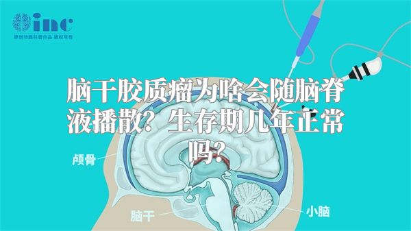 脑干胶质瘤为啥会随脑脊液播散？生存期几年正常吗？