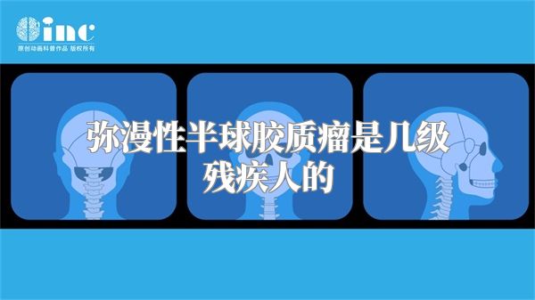 弥漫性半球胶质瘤是几级残疾人的