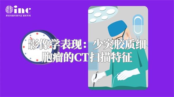 影像学表现：少突胶质细胞瘤的CT扫描特征