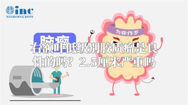 右额叶低级别胶质瘤是良性的吗？2.5厘米严重吗