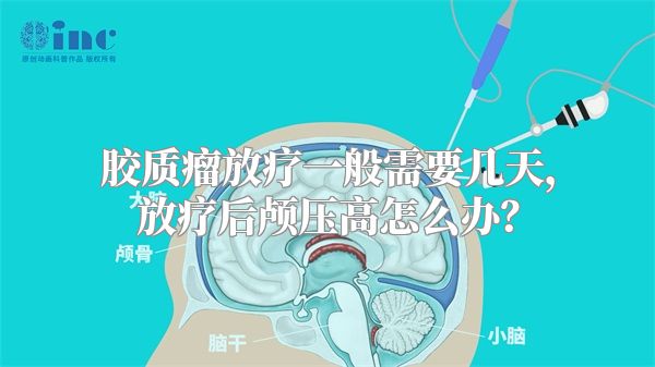 胶质瘤放疗一般需要几天，放疗后颅压高怎么办？