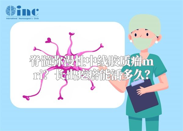 脊髓弥漫性中线胶质瘤mri？长出疙瘩能活多久？