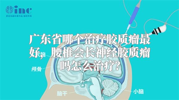 广东省哪个治疗胶质瘤最好，腰椎会长神经胶质瘤吗怎么治疗？