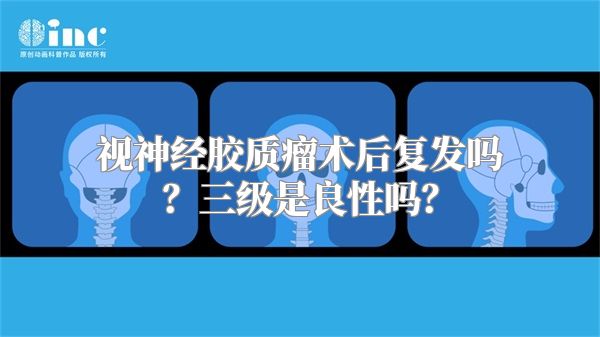 视神经胶质瘤术后复发吗？三级是良性吗？