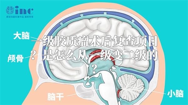 一级胶质瘤术后复查项目？是怎么从一级变二级的？